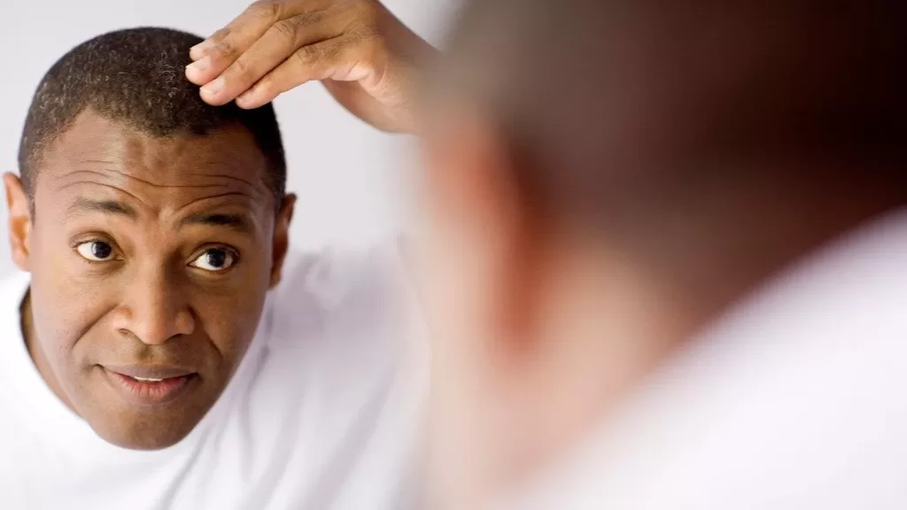 Causes of Hair Loss and Proven Solutions